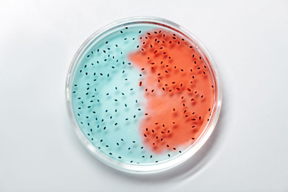 Analyse de l'impact du conflit social de Samsung Biologics sur les résultats du T2