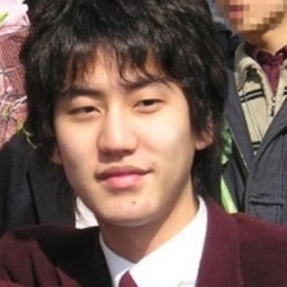 규현 성형전